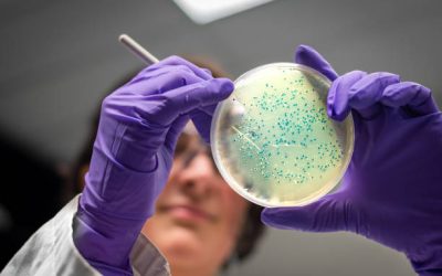 Listeria monocytogenes e il ruolo della proteomica: comprendere a fondo un patogeno alimentare